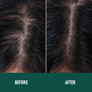 CH004 Minoxidil Anti-Hair Loss Mousse – Hair Growth Treatment for Men & Women